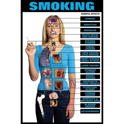 img1246 Prevence, kouření, alkohol: Škodlivé účinky kouření, 61x91cm