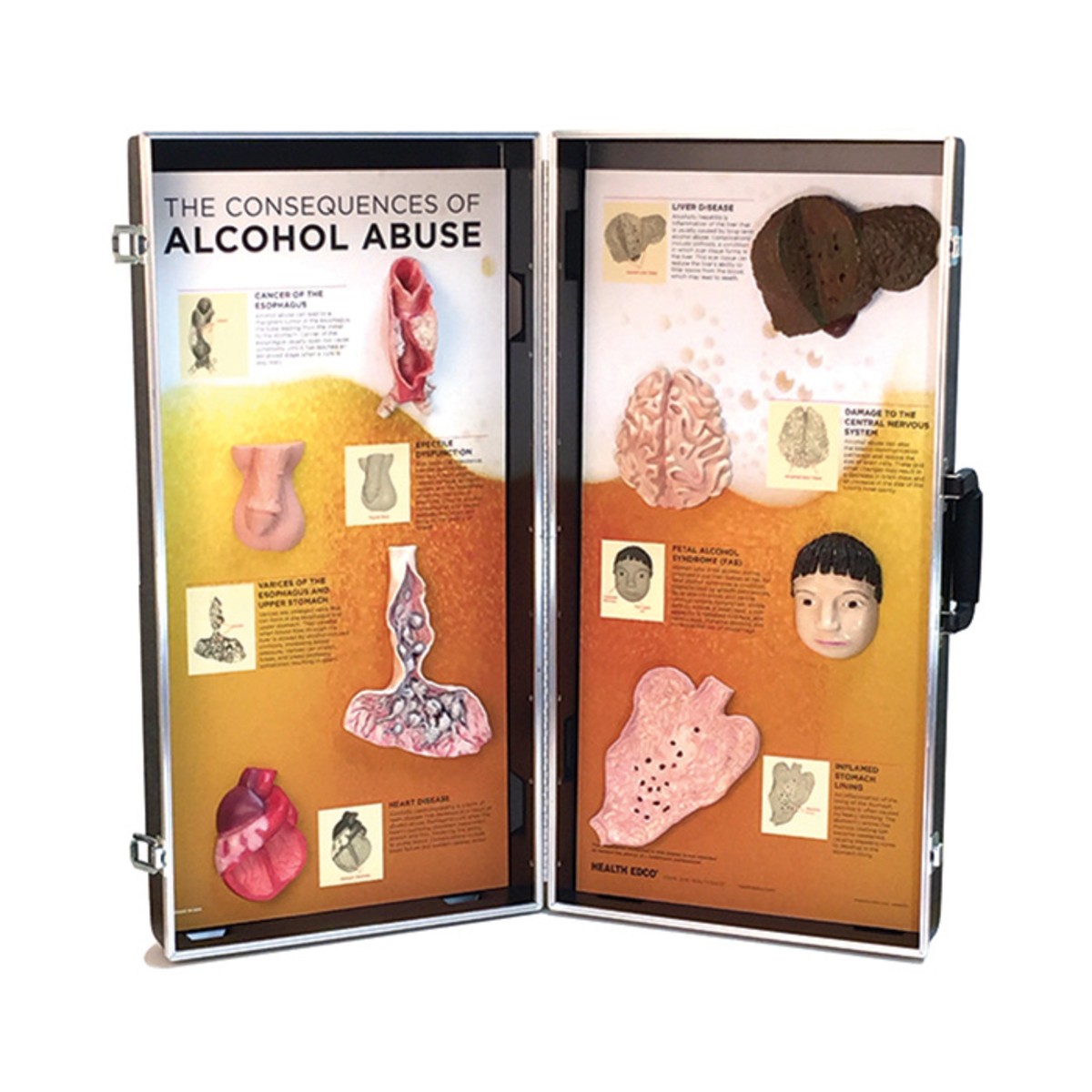 img1274 Prevence, kouření, alkohol: 3D zobrazení důsledků užívání alkoholu