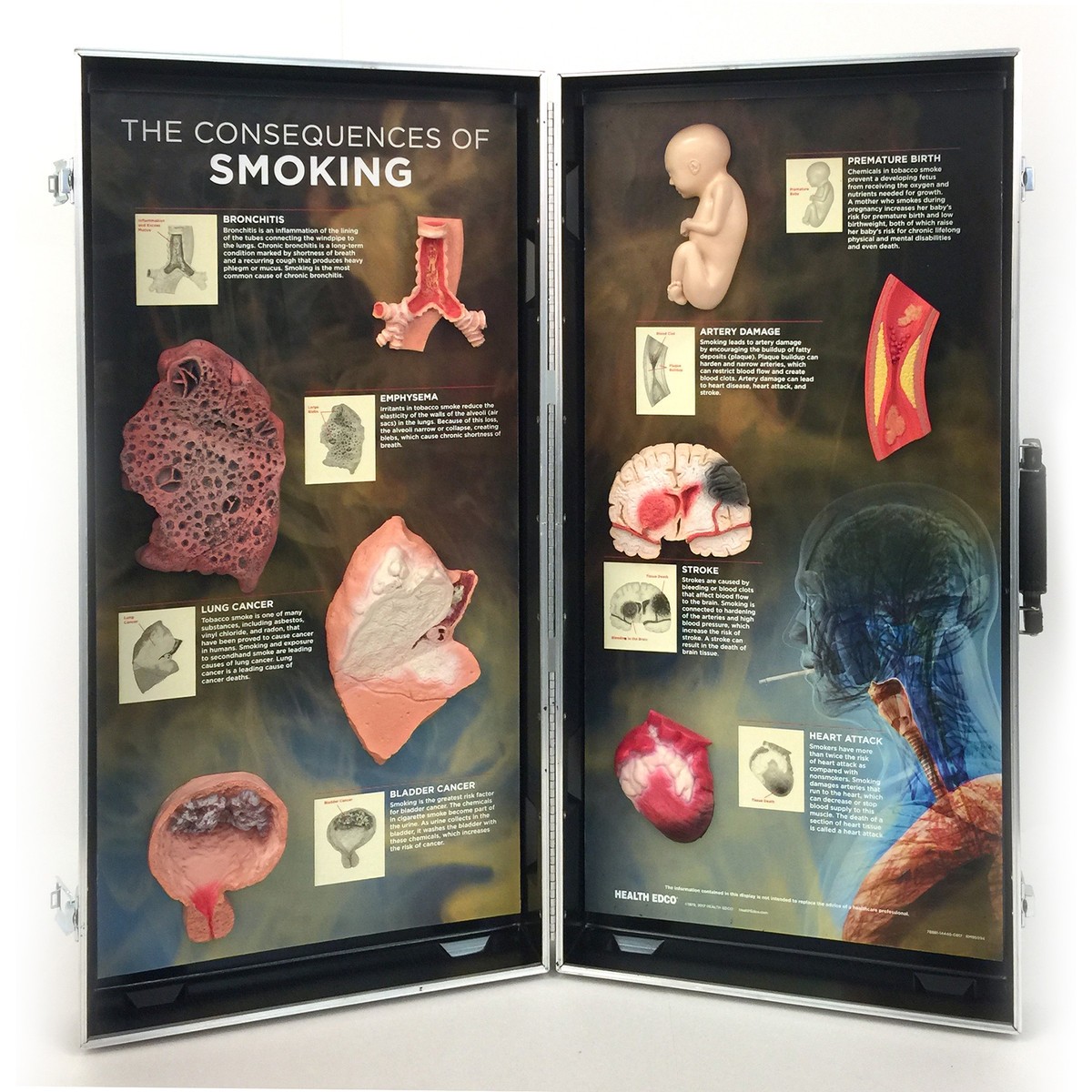 img1275 Prevence, kouření, alkohol: Sada 3D modelů následků kouření