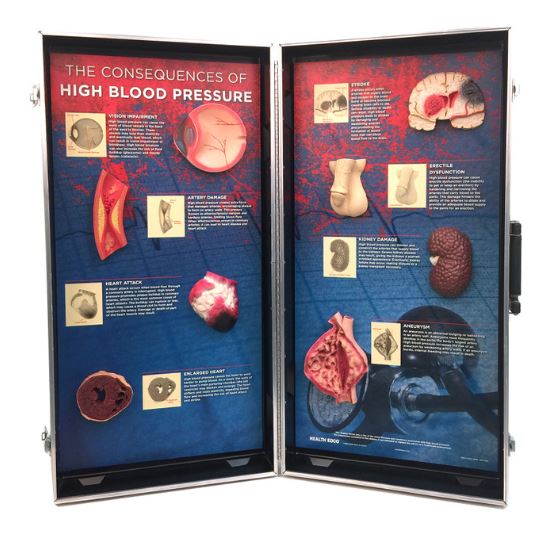 img1277 Prevence, kouření, alkohol: 3D zobrazení následků vysokého krevního tlaku