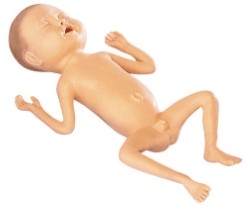 img2082 Kojenec: Předčasně narozené dítě,stáří 24 týdnů