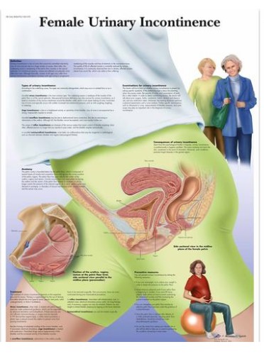 img357 Charts: Female Urinary Incontinence chart