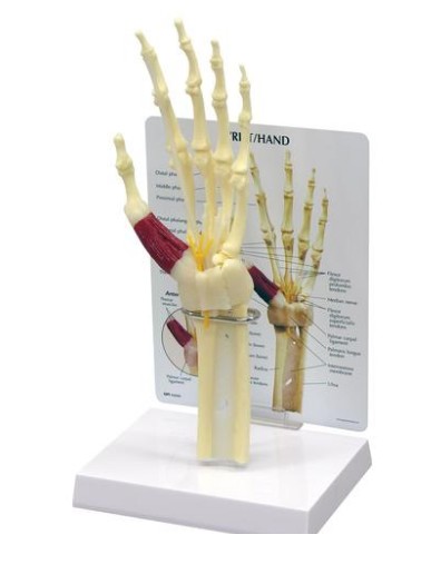 img747 Horní končetina: Model ruky se syndromem karpálního tunelu
