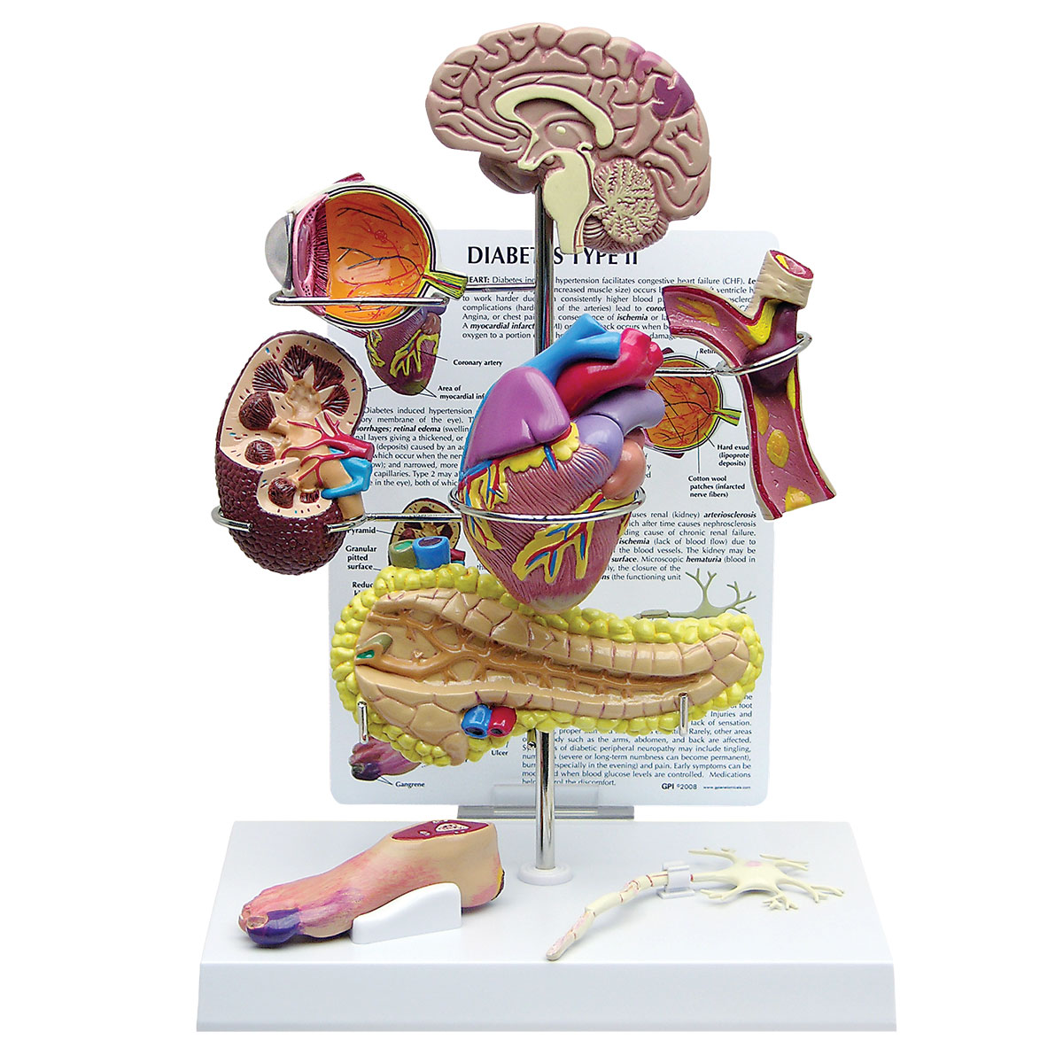 img795 Urologie: Model Malpighiho tělíska ledviny, 700krát zvětšeno - 3B Smart Anatomy
