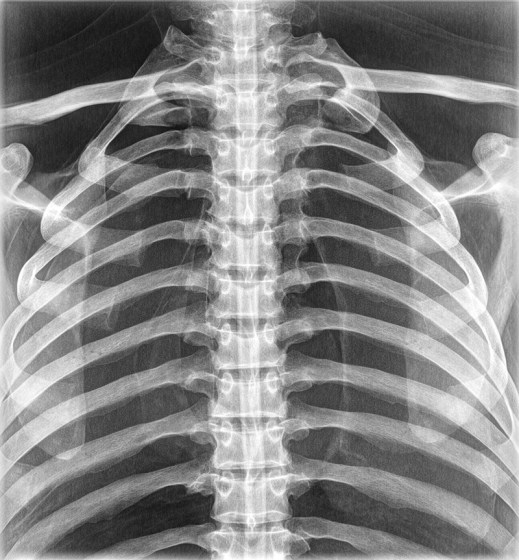 img1118-12